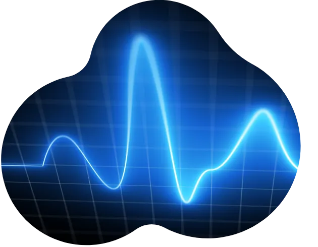 テルヴェプラスの特徴